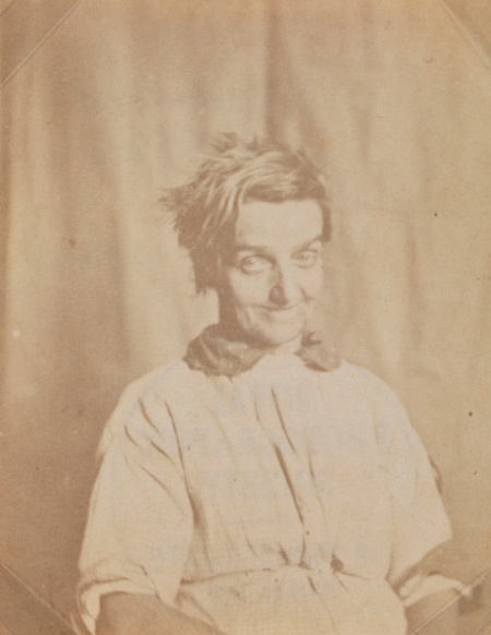 Πορτρέτο ασθενούς στο Άσυλο του Σάρεϊ, c 1855 από τον Dr. Χιου Ουέλτς Ντάιαμοντ (Dr Hugh Welch Diamond). Ο Ντάιαμοντ ήταν ψυχίατρος και φωτογράφος που συνήθιζε να φωτογραφίζει τους ασθενείς του για να κρατάει αρχείο της έκφρασης του προσώπου τους. Πίστευε πως οι καλοτυπίες του θα βοηθούσαν στην αγωγή ατόμων με προβλήματα διανοητικής υγείας.